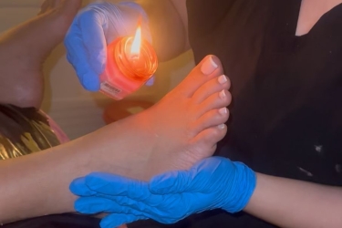 Veloterapia