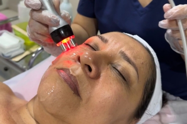 Ionización facial